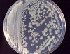 Űrutazó baktériumok